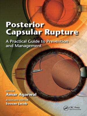 cover image of Posterior Capsular Rupture